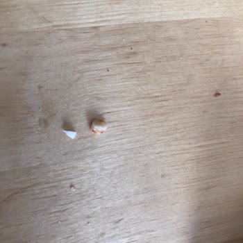 Sucuğun İçindeki Kemik Parçası Dişi Kırdı, Tazminat Talep Ediliyor