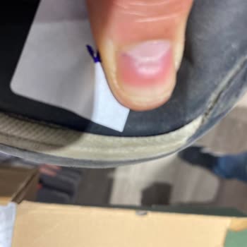 Deichmann Erkek Ayakkabısının İki Ayda Bozulması Ve İade Talebi