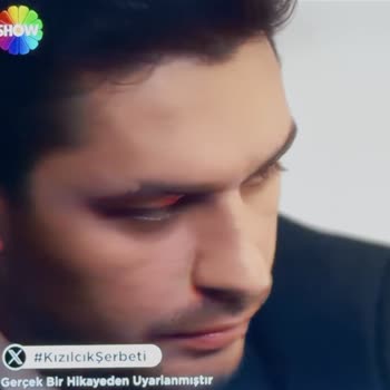 Onvo 65VQ90F3UA Televizyonda Yüz Ve Gölge Bölgelerinde Kırmızılaşma Sorunu