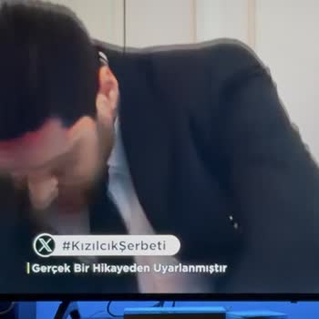 Onvo 65VQ90F3UA Televizyonda Yüz Ve Gölge Bölgelerinde Kırmızılaşma Sorunu