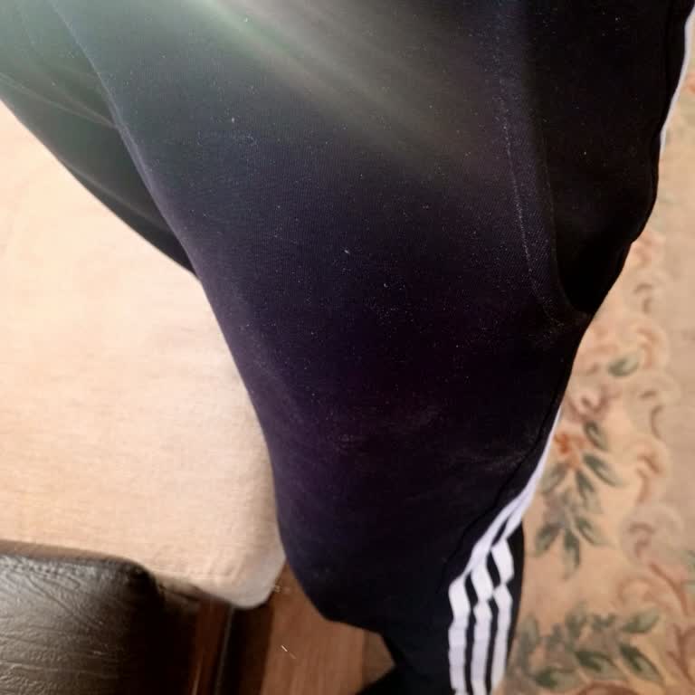 Baggy Style Yanıltıcı Ürün Görselleri Ve Cevapsız Müşteri Hizmetleri