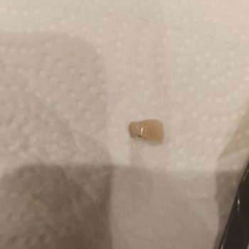 Ülker Jelibonunda İnsan Dişi Benzeri Parça Bulundu: Şok Ve Güvenlik Endişesi