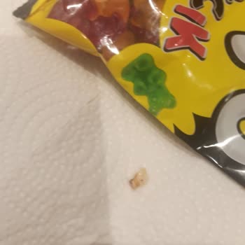 Ülker Jelibonunda İnsan Dişi Benzeri Parça Bulundu: Şok Ve Güvenlik Endişesi