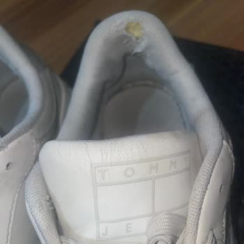 Tommy Jeans Kadın Ayakkabısında Hızlı Deri Soyulması Ve Şirketten Cevapsızlık