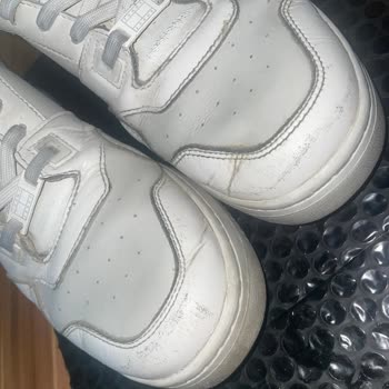 Tommy Jeans Kadın Ayakkabısında Hızlı Deri Soyulması Ve Şirketten Cevapsızlık