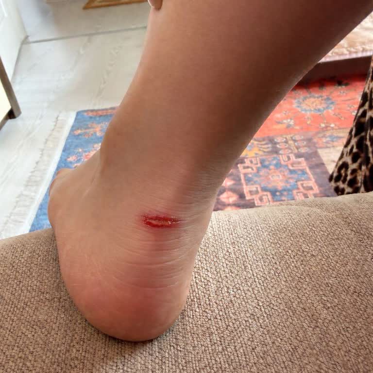 Garanti Kapsamında Bileği Yaran Çizmeler İçin Hızlı Ve Kalıcı Çözüm Talebi