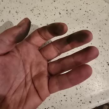 Metal Boyası Sürekli Sızdırıyor, Makine İşlevsiz Ve Hijyenik Değil