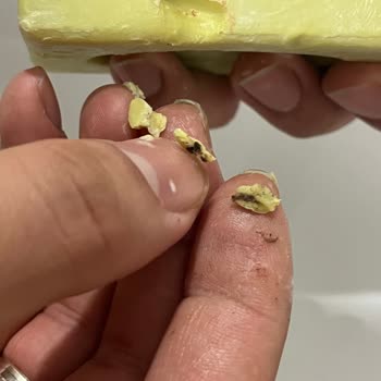 Zeytinyağlı Sabunun İçinden Çıkan Yabancı Madde Cildimde Çizik Ve Tahrişe Neden Oldu