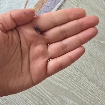 Tüy Bırakan Battaniyeler Nedeniyle Hijyen Sorunu Ve İade Talebi