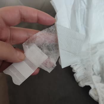 Molfix Bebek Bezlerinde Bant Yırtılması Sorunu Ve İade Talebi