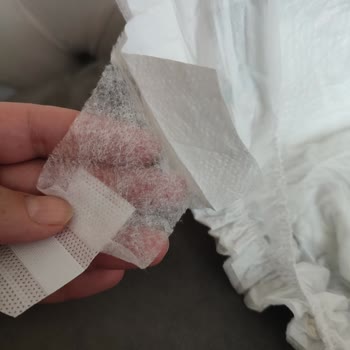 Molfix Bebek Bezlerinde Bant Yırtılması Sorunu Ve İade Talebi