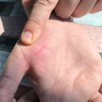 Berrak Suyun Şişesini Açarken Ciddi Bir Sorun Yaşadım