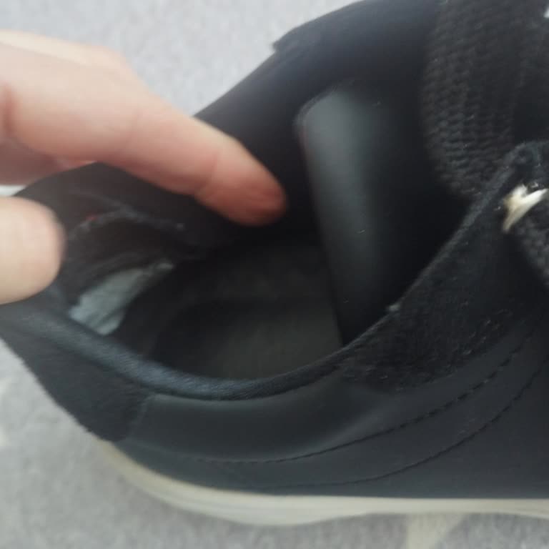 Marjin Ayakkabısında Patlama Ve Sünger Dökülmesi, İade Reddi Ve Kullanıcı Hatası İddiası