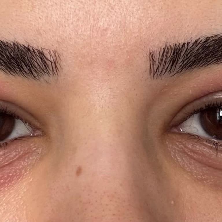 Note Farı Alerjisi Nedeniyle Ücret İadesi Ve Ürün İncelemesi Talebi