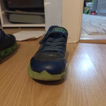 Skechers Çocuk Ayakkabısı 5 Ayda Yamuldu, Üretim Hatası Reddedildi