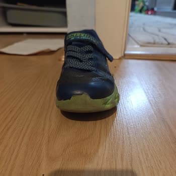 Skechers Çocuk Ayakkabısı 5 Ayda Yamuldu, Üretim Hatası Reddedildi