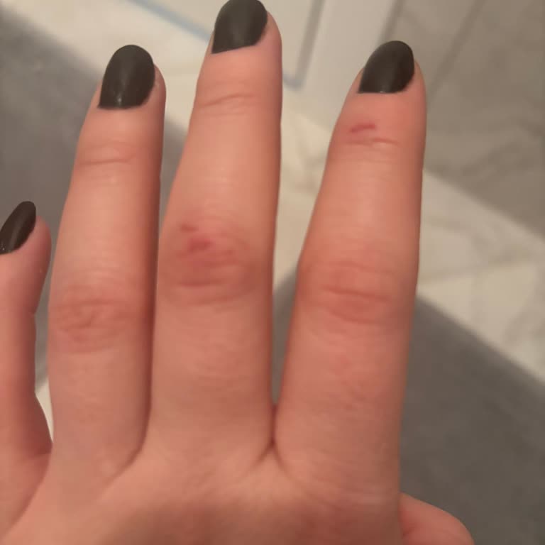 Villa Black Sea Hotel Müşteriye Fiziksel Şiddet Ve Tehdit Uygulayan Restoran