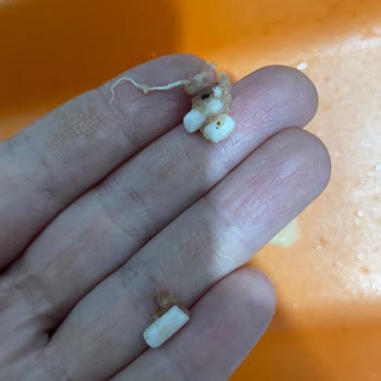 Köfte İçin Aldığım Kıyma Parçalı Ve Yağlı Çıktı, Misafirler Önünde Mahcup Oldum