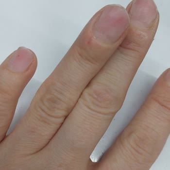 Bahar Acar Güzellik Merkezi’nde İşini Bilmeyen Personel Nedeniyle Tırnaklarda Şiddetli Hasar