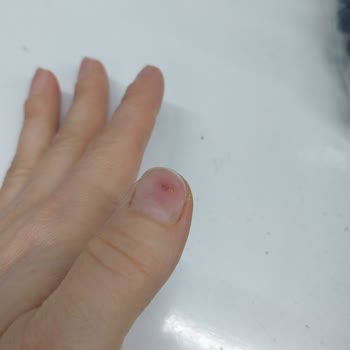 Bahar Acar Güzellik Merkezi’nde İşini Bilmeyen Personel Nedeniyle Tırnaklarda Şiddetli Hasar