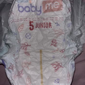 Bebek Bezinde Cilt Yanığı Ve Kanama: Ücret İadesi Talebi