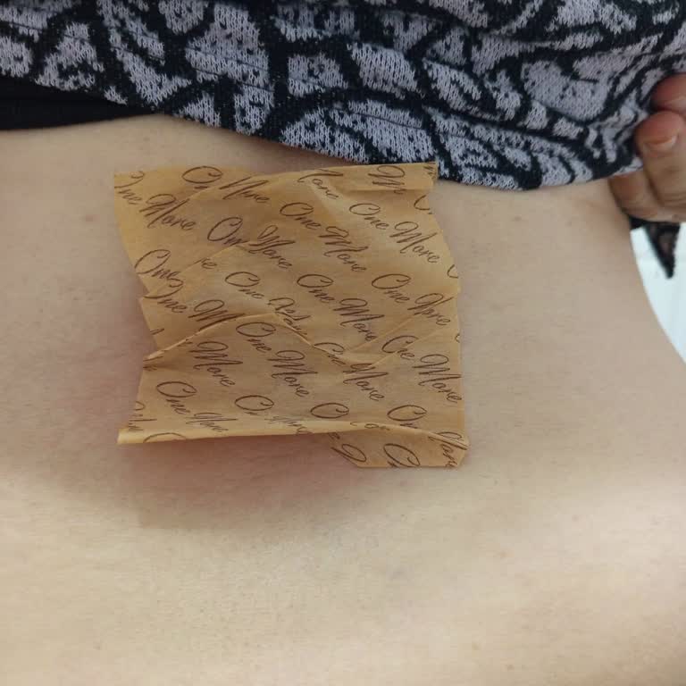 Kusurlu Ağrı Bandı, İade Talebim Reddedildi