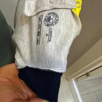 Ayıplı Ürün İadesi Sonrası Hesabım Haksızca Kapatıldı