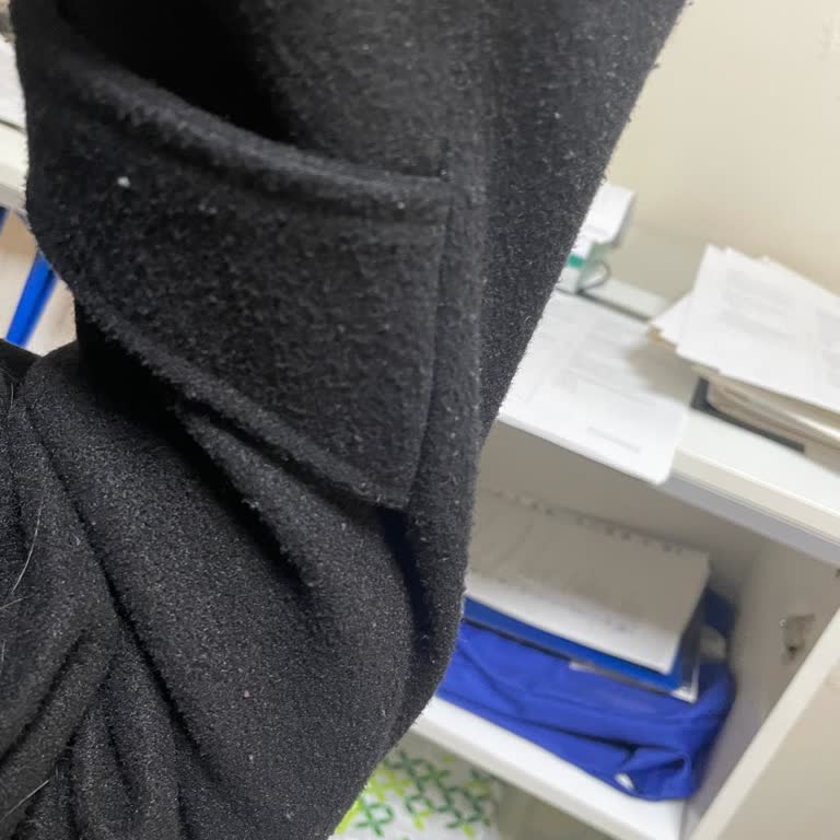 DeFacto Kabanında Tüylenme Ve Trendyol Üzerinden Alınan Ürün İçin Değişim Süresi Reddi