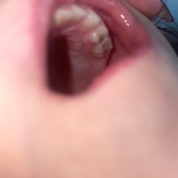 Narlıdere Çocuk Diş Hekiminin Saygısız Tutumu Ve Tedavi İptali Kızımın Ağrısını Uzattı