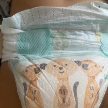 Sürekli Sızdırma Sorunu Ve Müşteri Hizmetlerinden Çözüm Bekleniyor