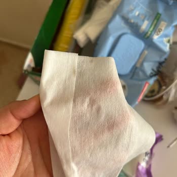 Family Markalı Islak Mendilde Küflenme Şüphesi Ve Hijyen Endişesi