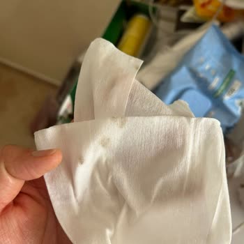 Family Markalı Islak Mendilde Küflenme Şüphesi Ve Hijyen Endişesi