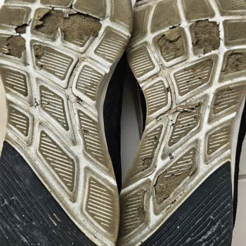 Skechers Ayakkabısının Kısa Sürede Deforme Olması Ve Kalite Güveninin Sarsılması