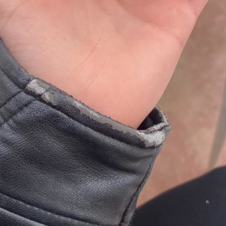 Zara Deri Cekette Kolların Deri Atması Ve Değişim Talebi