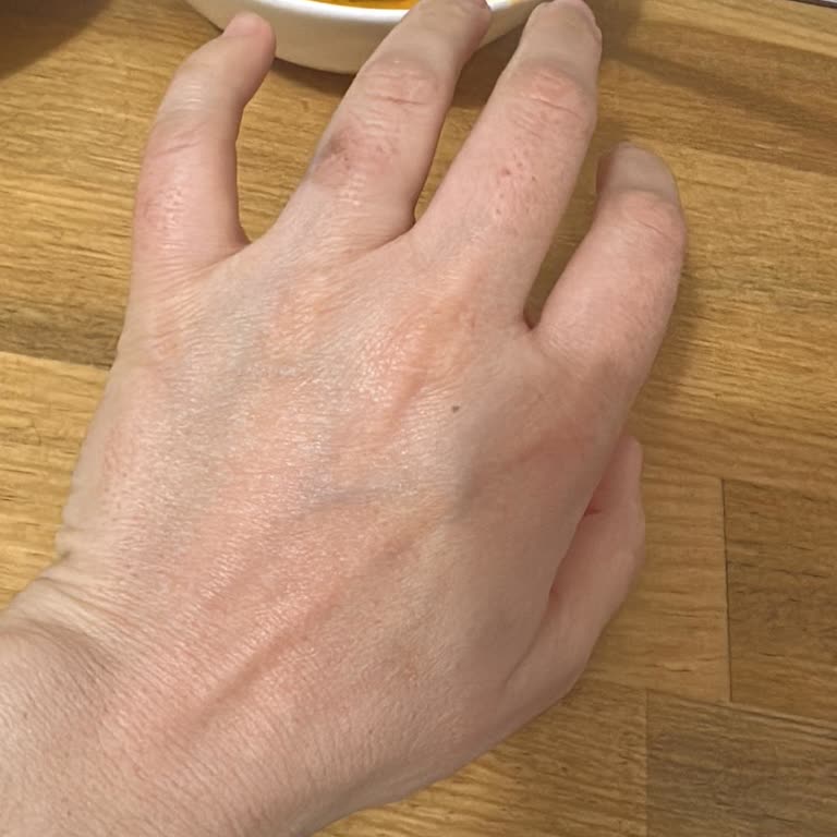 Dr. Veysel Gezen Hem Cihaz Güvenliği Hem De Doğru Kullanım Konusunda Ciddi Şekilde Endişelendirdi