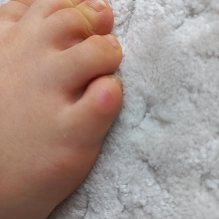 Kızımın Ayağında Şiddetli Ağrı Yaratan Bot, Değişim Ya Da İade Talebi