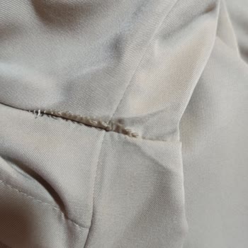 Stradivarius Trençkotunda Kısa Sürede Dikiş Açılması Ve Kol Sorunu