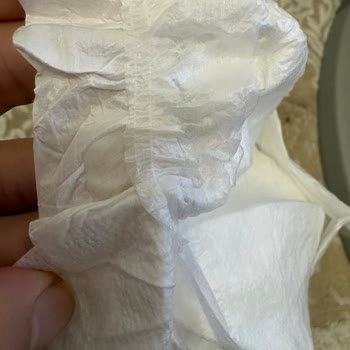 Molfix Bebek Bezinde Yabancı Maddeler Ve Sağlık Riski