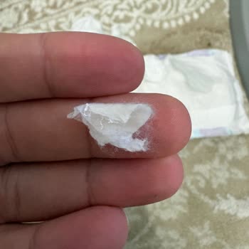 Molfix Bebek Bezinde Yabancı Maddeler Ve Sağlık Riski