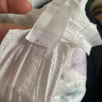 Molfix Bebek Bezinde Yabancı Maddeler Ve Sağlık Riski