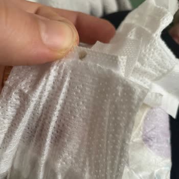 Molfix Bebek Bezinde Yabancı Maddeler Ve Sağlık Riski