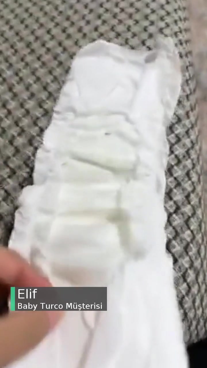 Baby Turco Bezden Yabancı Madde Çıktı! videonun kapak resmi