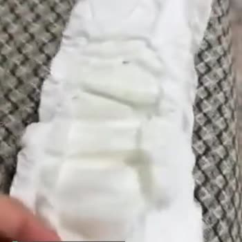 Baby Turco Bezden Yabancı Madde Çıktı!