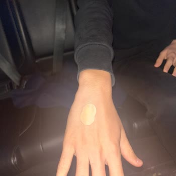 Kocaeli Atakent Cihan Hastanesi Çocuğumun Kan Damarına Üç Kez Başarısız Deneme