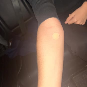 Kocaeli Atakent Cihan Hastanesi Çocuğumun Kan Damarına Üç Kez Başarısız Deneme