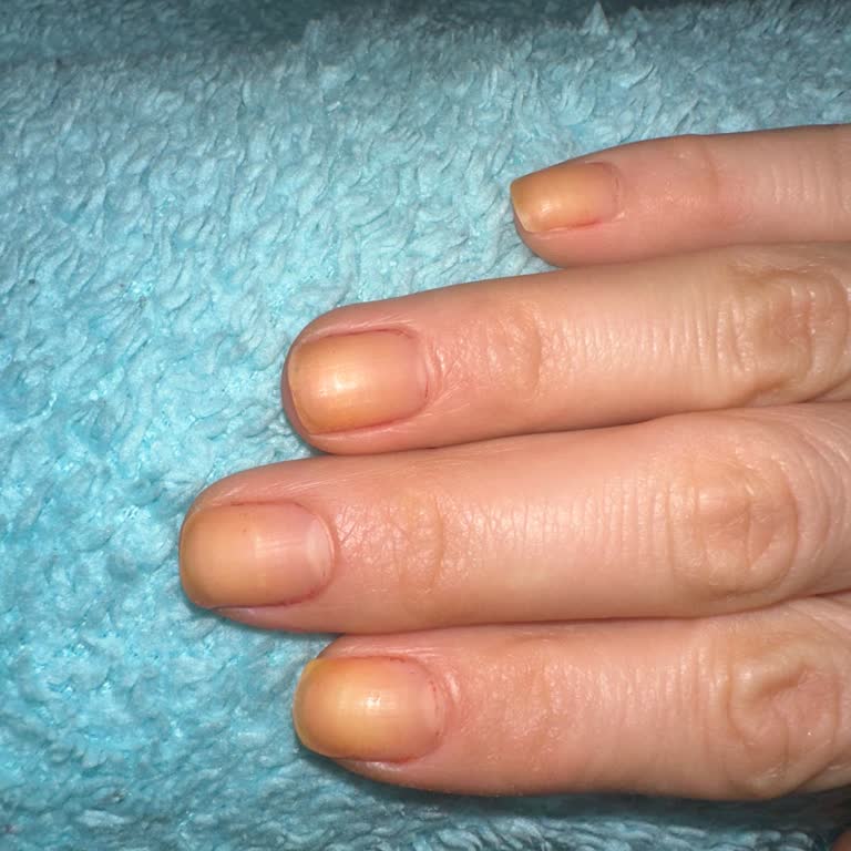 Pastel 99 Kırmızı Oje Turuncu İz Bırakıyor, Sağlık Açıklaması İstiyorum