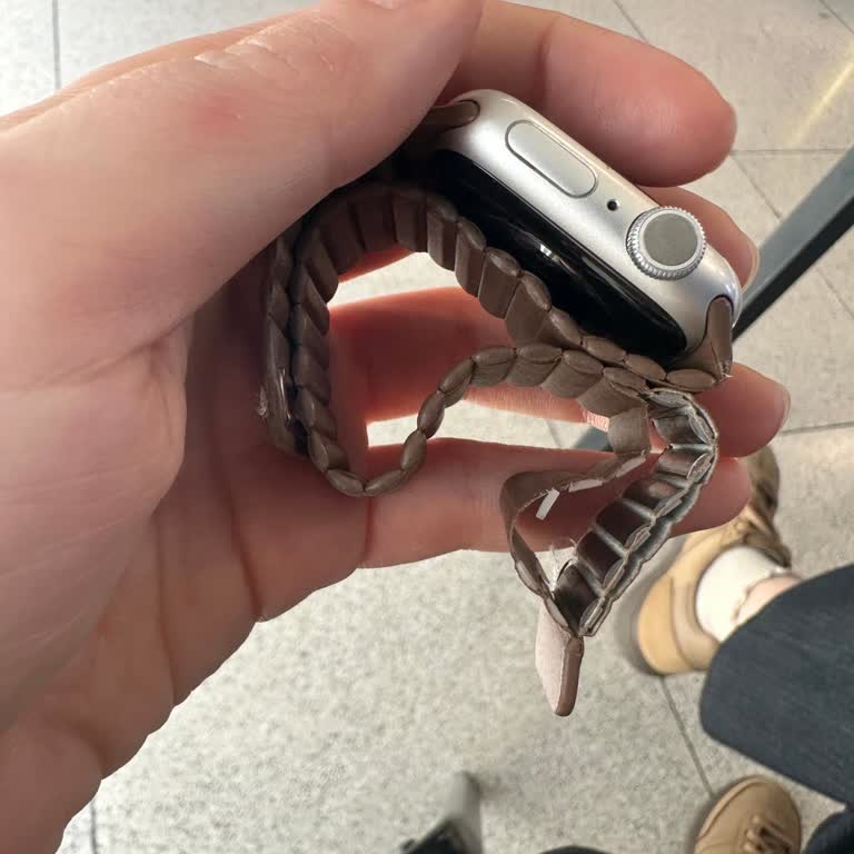 Apple Watch Deri Kordonun 3 Ayda Parçalanması Ve Satıcıdan Destek Almada Başarısızlık