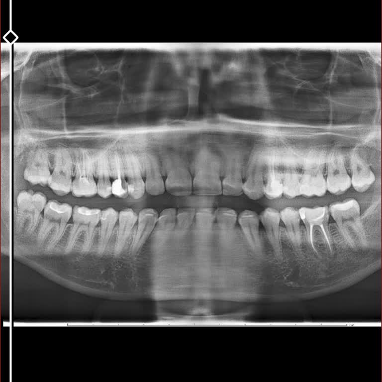 Hamilelik Planı Nedeniyle Şiddetli Diş Ağrısı Ve Çekim Talebi Geçiştirilerek Yönlendirilmedi