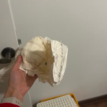 Bebek Bezinde Siyah Lekeler Ve Mürekkep Gibi Sızıntı: Sağlık Endişesi