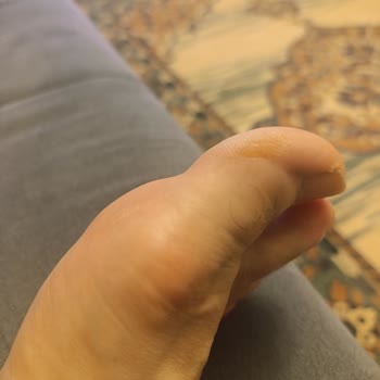 Ayak Sağlığını Zedeleyen Ayakkabının Değişim Talebi Reddedildi